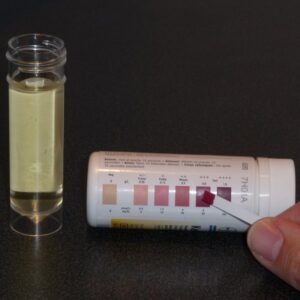 ketostix intensity (semakin ungu kadar acetone semakin besar)